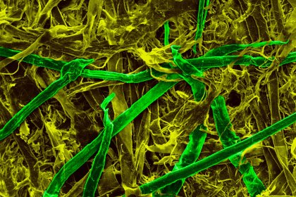 Coloured scanning electron micrograph (SEM) of cellulose fibres at a magnification of 35 times. Photo: Dennis Kunkel | ANP | Science Photo Library Coloured scanning electron micrograph (SEM) of cellulose fibres at a magnification of 35 times. Photo: Dennis Kunkel | ANP | Science Photo Library