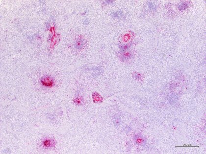 Another microscopic image: PCV3 virus photographce in a pig’s spleen. - Photo: CReSA-IRTA Another microscopic image: PCV3 virus photographce in a pig’s spleen. - Photo: CReSA-IRTA