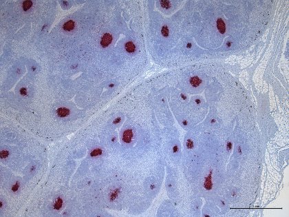 PCV3 was also found in lymph nodes, as can be seen in this microscopic image. - Photo: CReSA-IRTA PCV3 was also found in lymph nodes, as can be seen in this microscopic image. - Photo: CReSA-IRTA