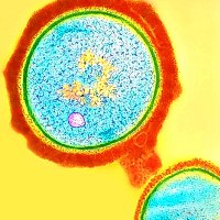 MRSA superbug widespread in Pigs